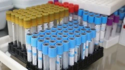 Ставропольцев приглашают сдать кровь для пострадавших в «Крокус Сити Холле»