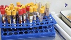 На Ставрополье показатель заболеваемости ВИЧ-инфекцией за год снизился на 4,6%